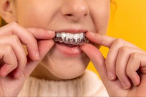 Invisalign or Braces: Which is Best for You?