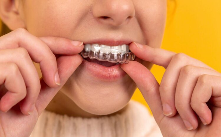  Invisalign or Braces: Which is Best for You?